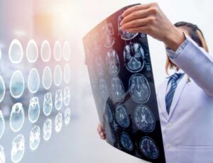 Types of Brain Injuries and Symptoms | coup contrecoup symptoms